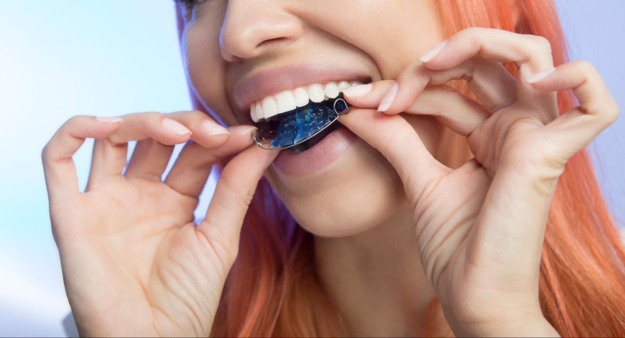 Tips for Transitioning From Braces to Retainers